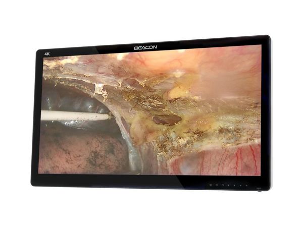 Монитор медицинский Beacon 32 4К Монитор медицинский Beacon 32 4К